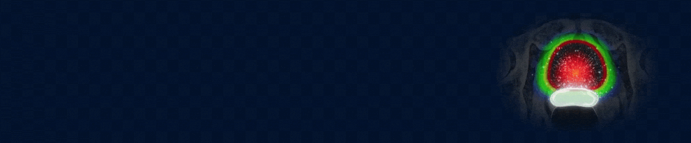 SpaceOAR Vue Hydrogel - Radiopaque Perirectal Spacer - Boston Scientific
