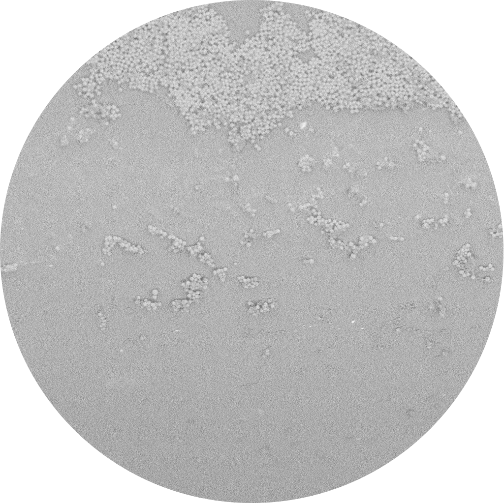 SELUTION SLR™ DEB  Sirolimus Drug Post-tracking.