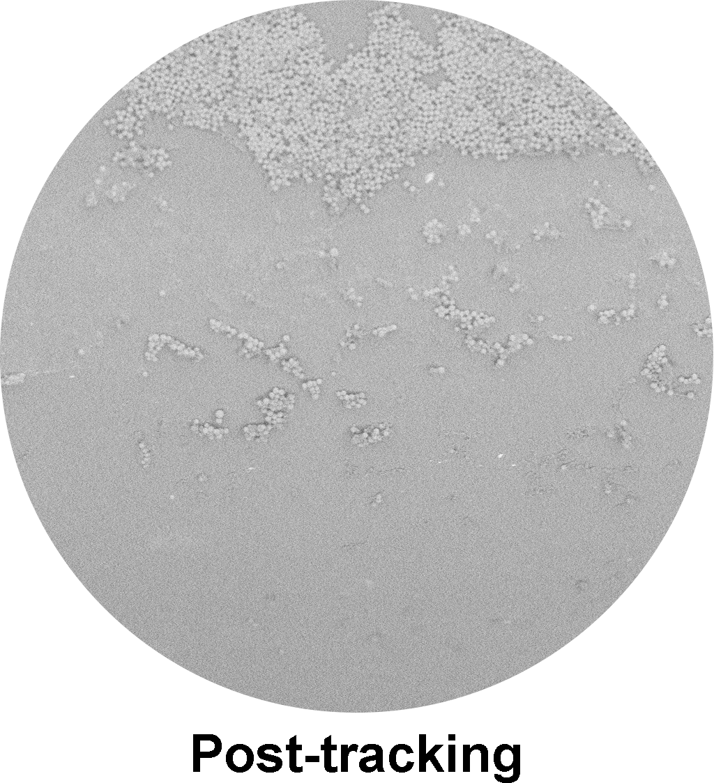 SELUTION SLR™ DEB  Sirolimus Drug Post-tracking.