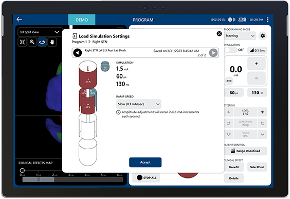 Tablet with Vercise Neural Navigator 5 Software showing a pre-planned stimulation option.