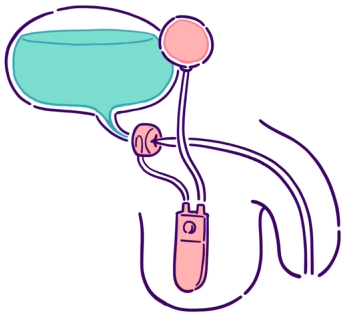 人工尿道括約筋植込術