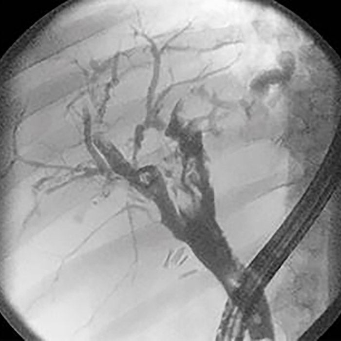 Fluoroscopic visualization​