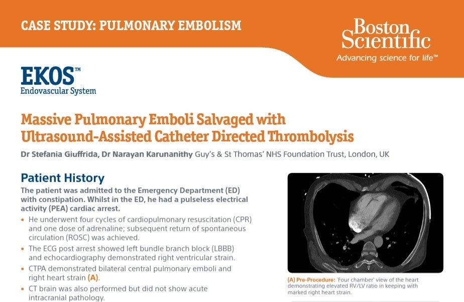 Massive Pulmonary Emboli