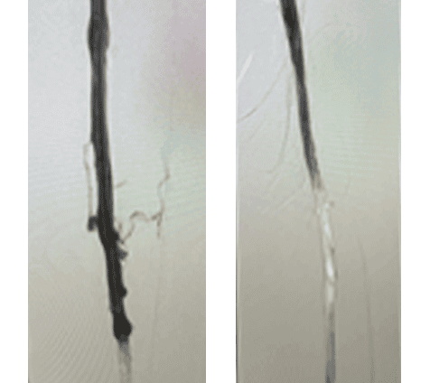 Scans of veins post Smartclaw.