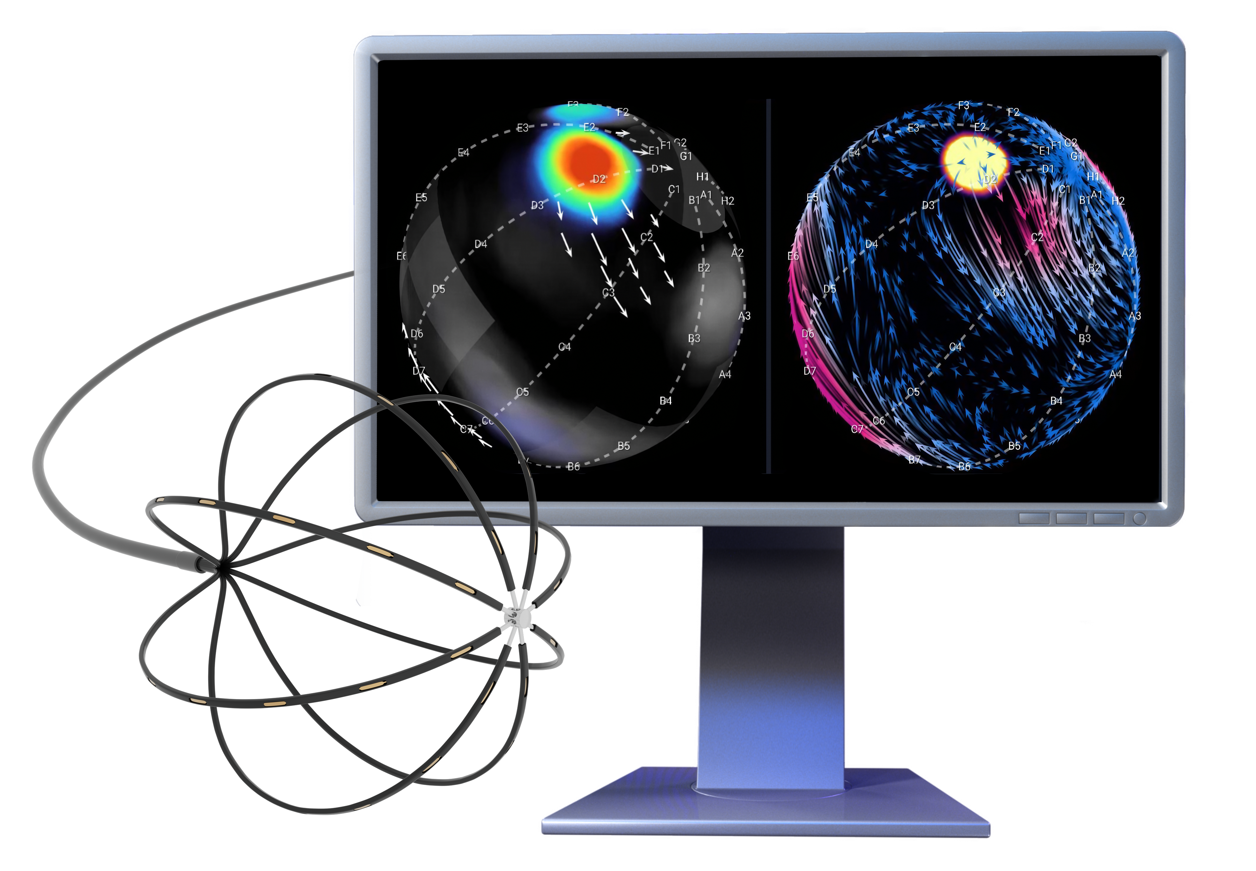 Optimap system