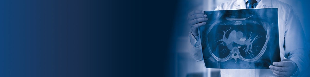 Advancing standards of care for Pulmonary Embolism