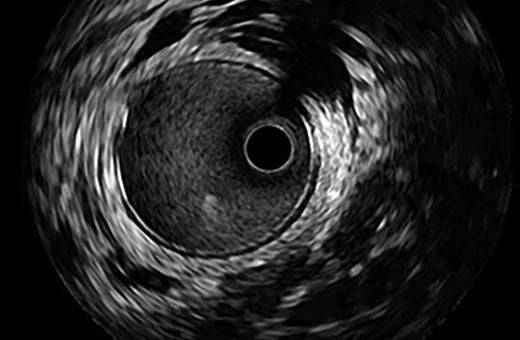 IVUS image for the IVUS image library in Educare