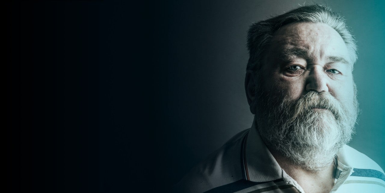 Older patient looking directly at the camera.