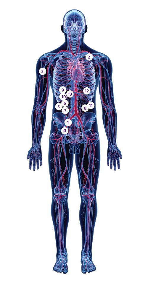 obsidio-skeletal-image-with-numbered-callouts.