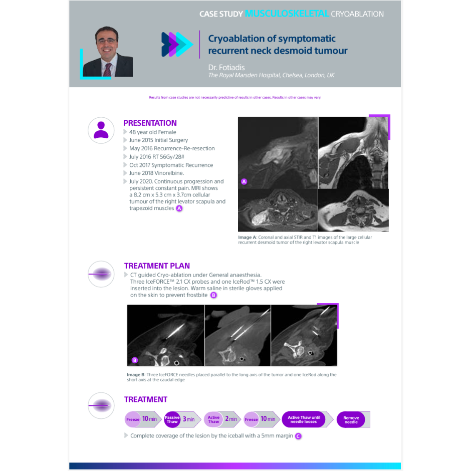 Cryoablation-2.3cm-RCC