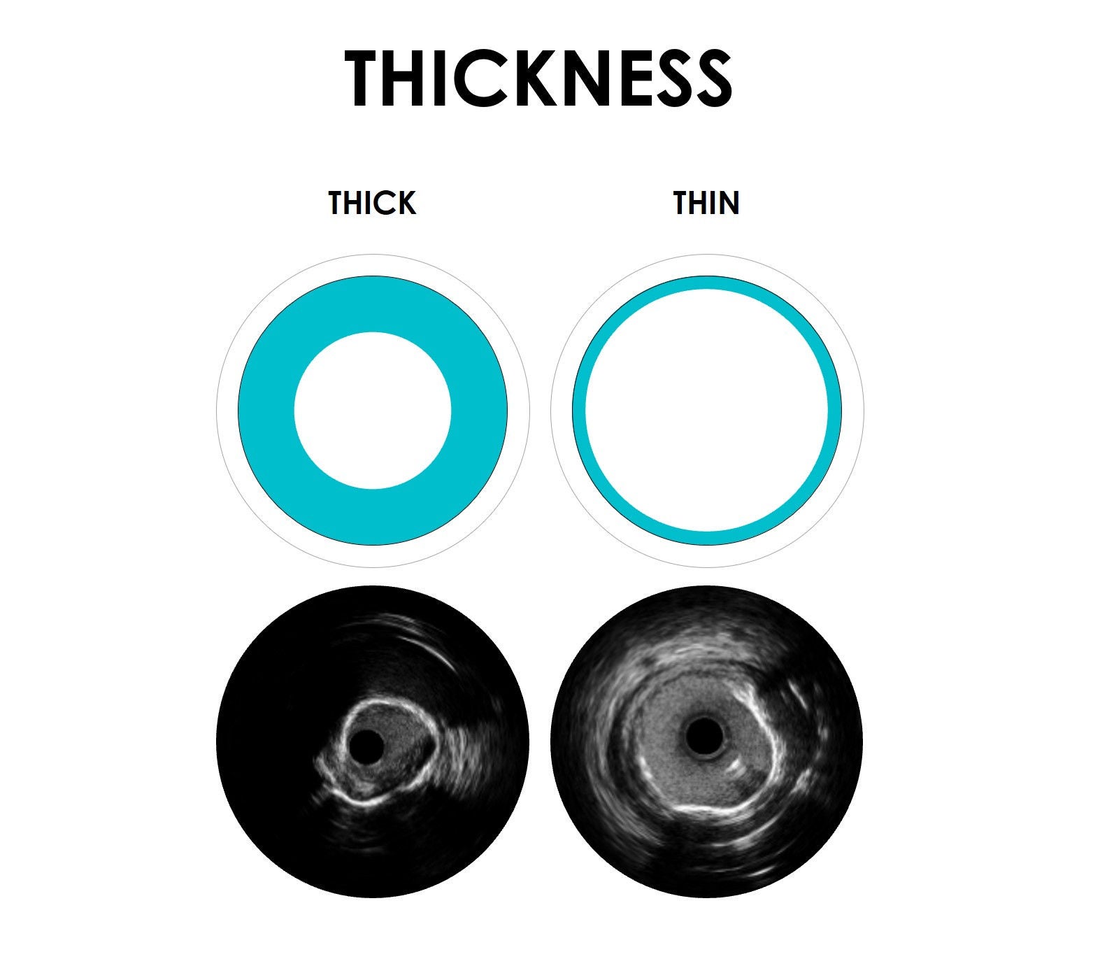 THICKNESS