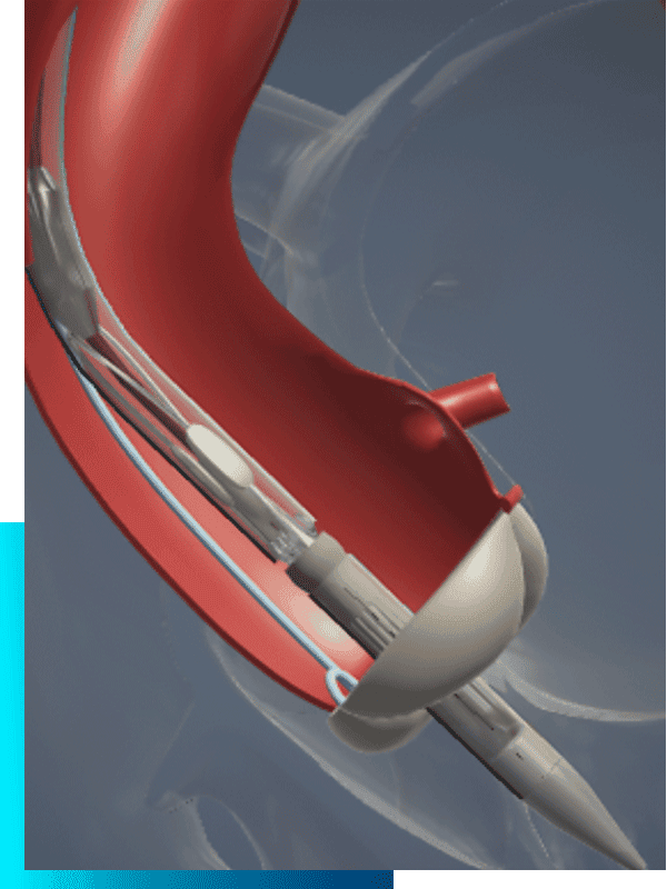 Commisural alignment 3D online tool