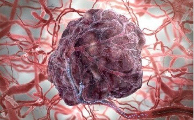 A medical view of the internal process of TheraSphere Y90 therapy.