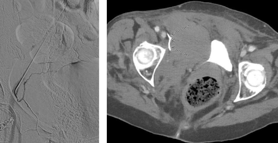 Scan images from Obsidio case.
