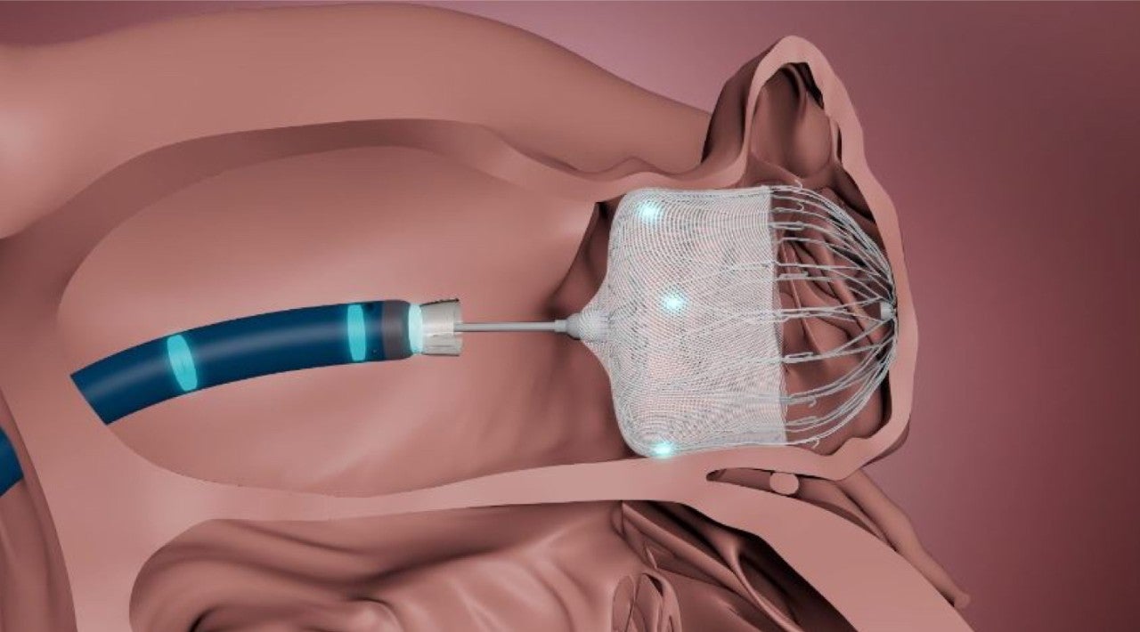 WATCHMAN TruSteer Access System placing WATCHMAN device