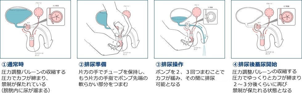 作動メカニズム