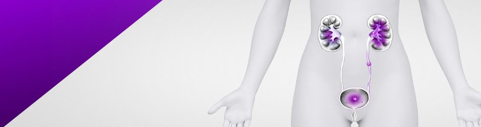 kidney-stones-cystine-calcium-struvite-uric-acid