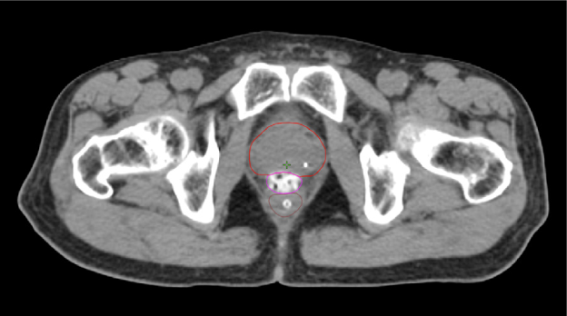  SpaceOAR Vue-CT image.