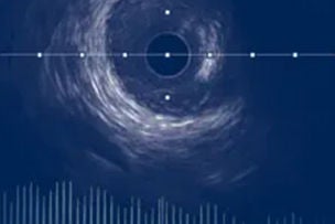 Screenshot of a screen in the IVUS + Physiology Pro app.