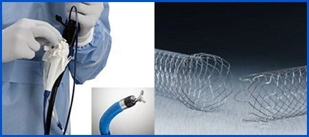 エンドスコピー（消化器分野）