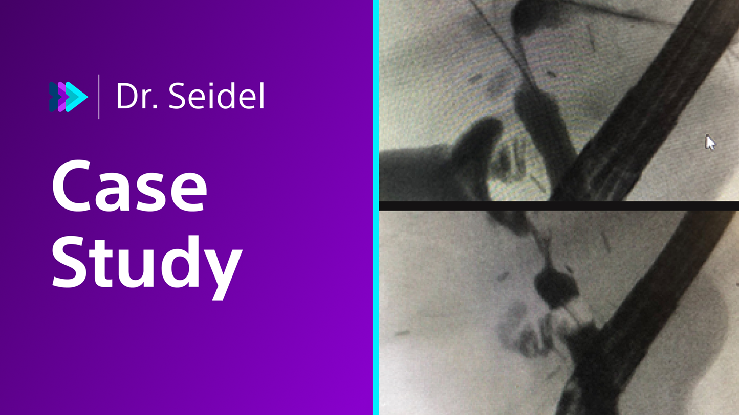 Dr. Seidel case study.