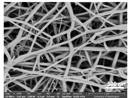 Fibrin before EKOS ultrasound.