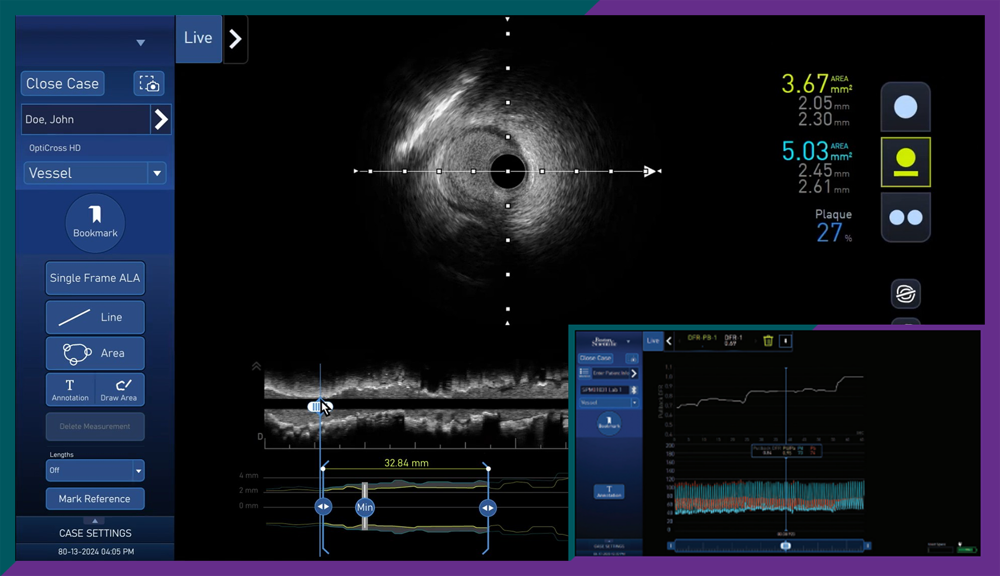 AVVIGO+ System monitor example. 