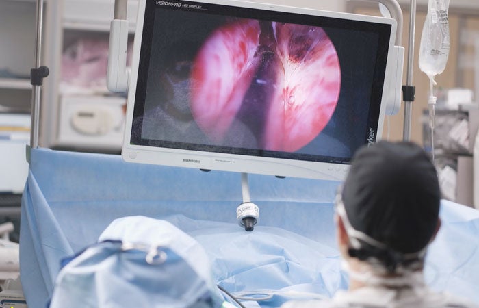 Backside of the head of a physician in the OR working on a patient looking up at a monitor. 
