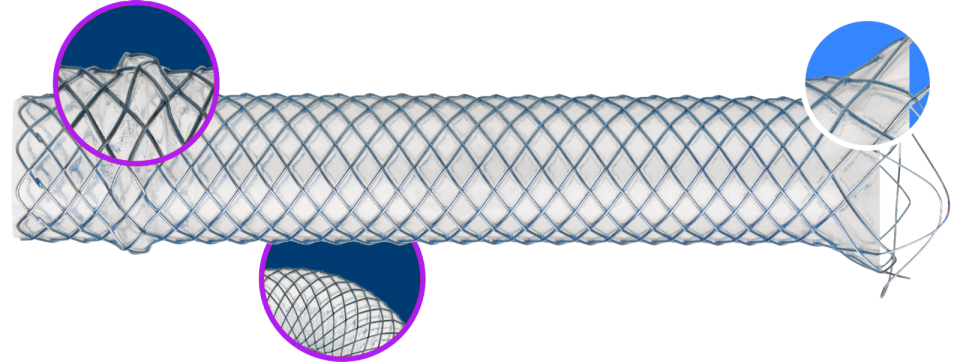 WallFlex Biliary PLUS Metal Stent.
