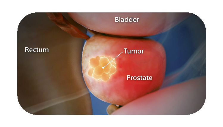 WithoutSpaceOAR image.