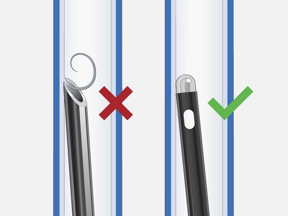 Transseptal Needle with skiving and red X, and NRG Transseptal Needle with no skiving, rounded tip, and green checkmark.