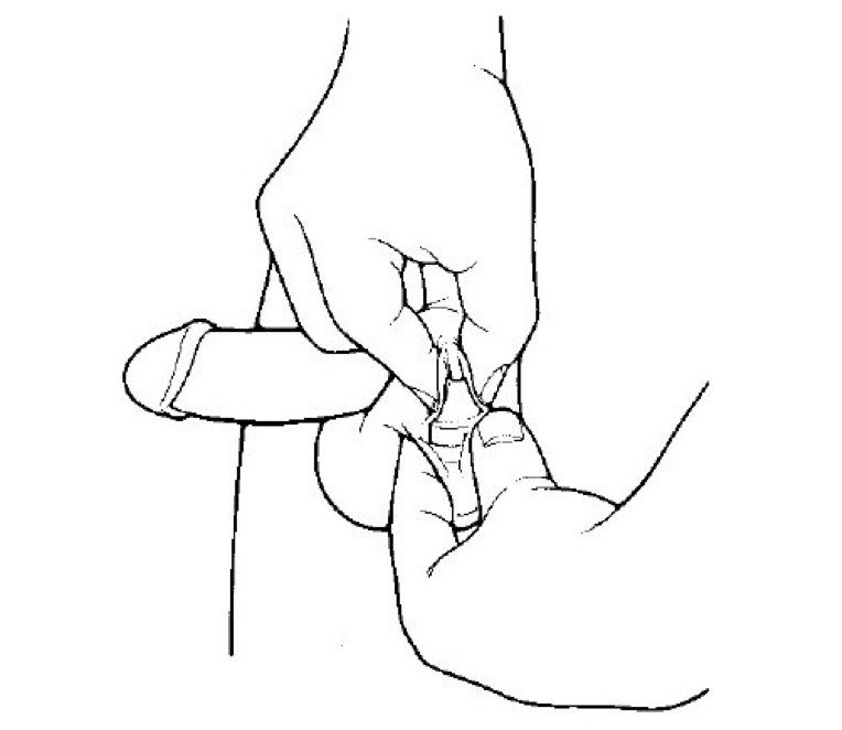 AMS Ambicor inflation 