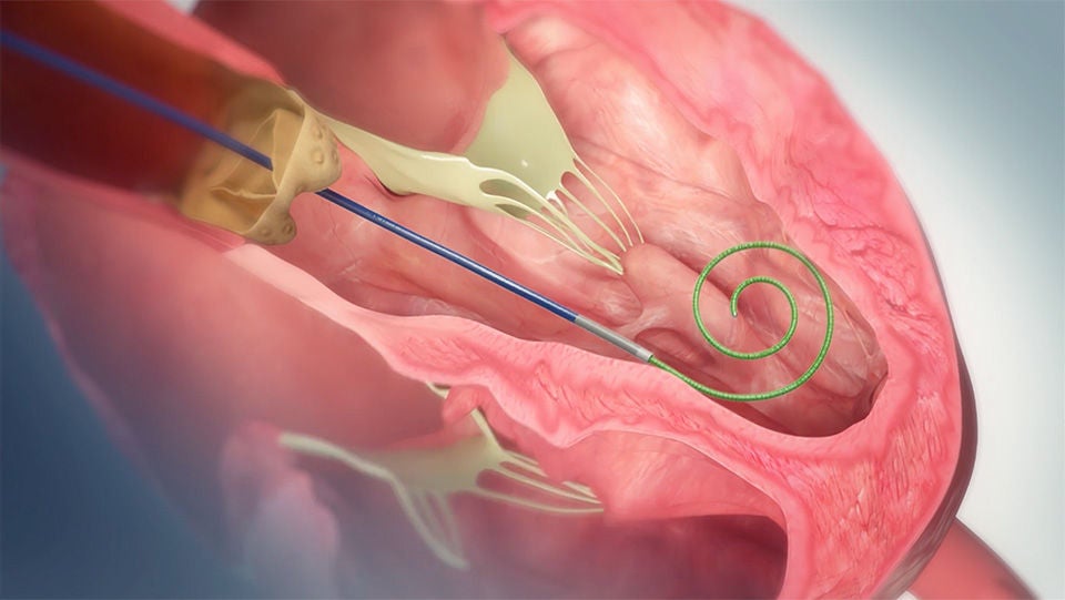 Safari's optimized rail support provides streamlined and accurate device delivery for transcatheter aortic procedures.
