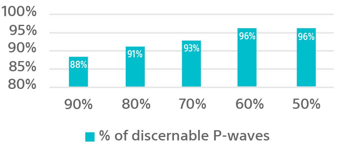 Data chart showing the P-Wave visibilty of the LUX-Dx Insertable Cardiac Monitor (ICM) System through 180 days post insertion.