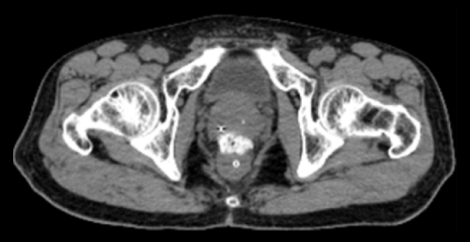 Computed Tomography images.