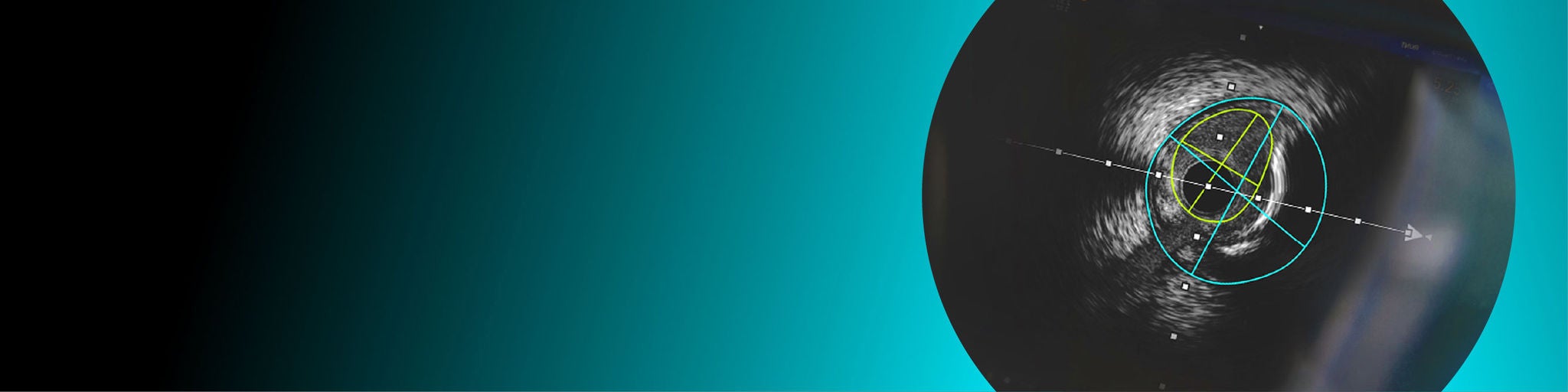 High Users Homepage AI-assisted interpretation banner