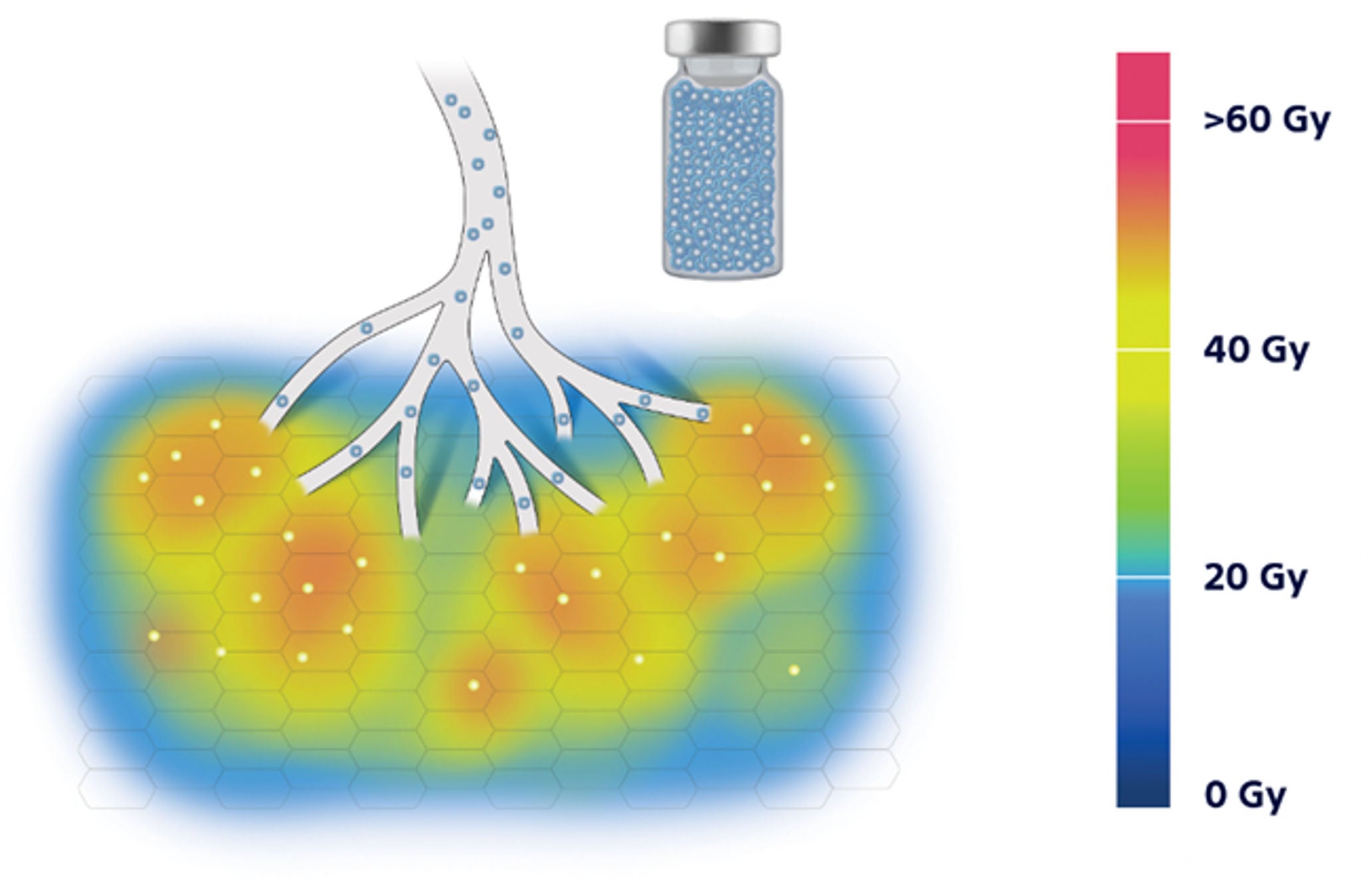 Lower RPM and more spheres results in more healthy tissue exposed
