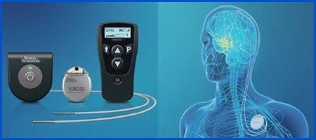 ニューロモジュレーション（脳神経外科分野）