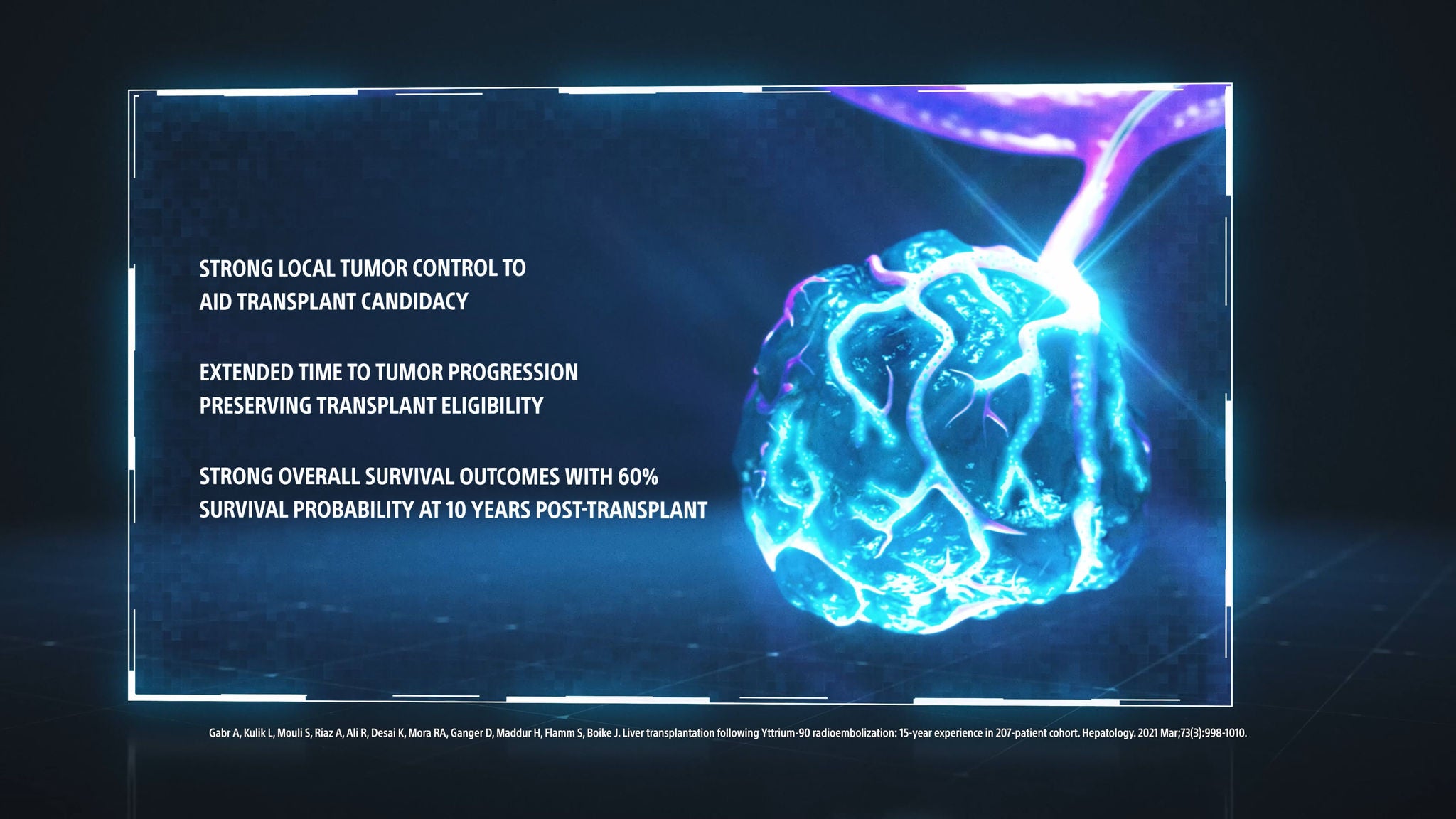 Bridging and downstaging.