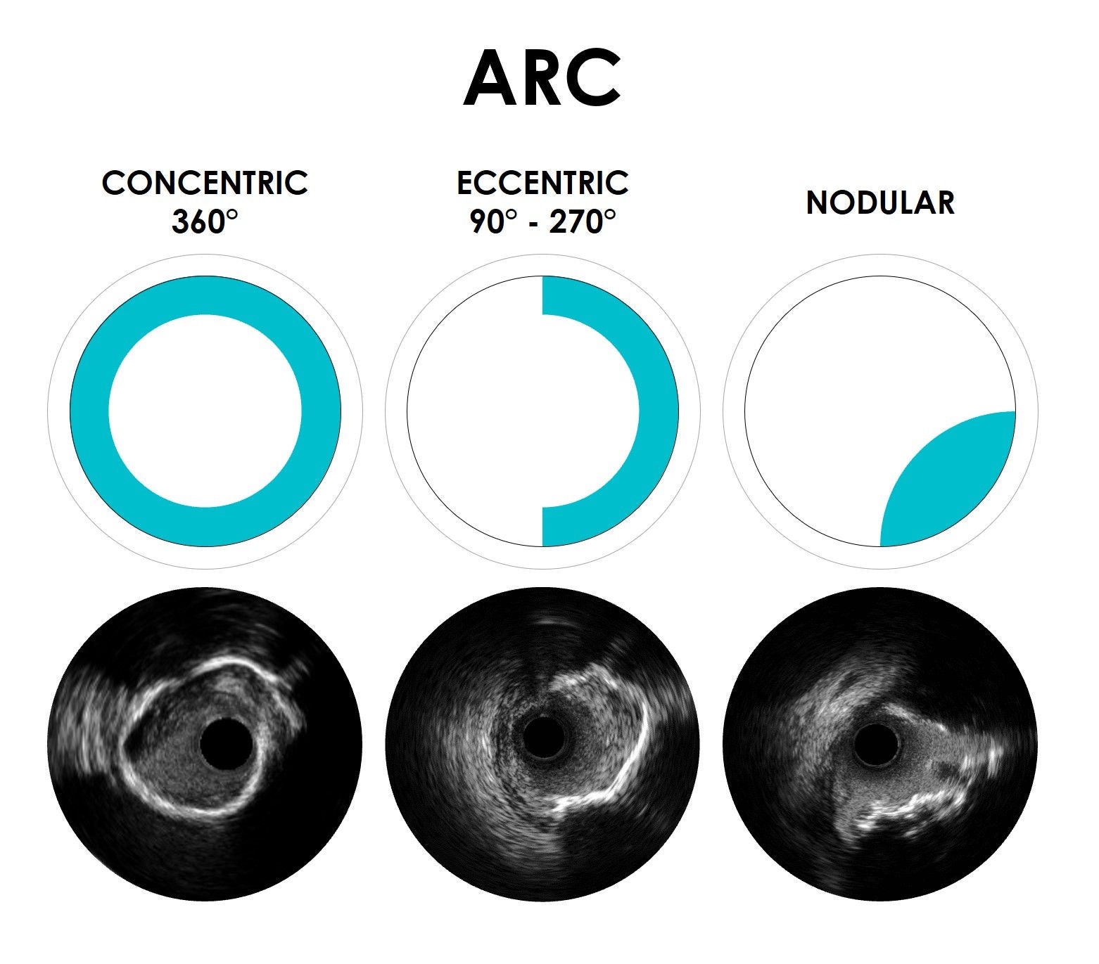ARC