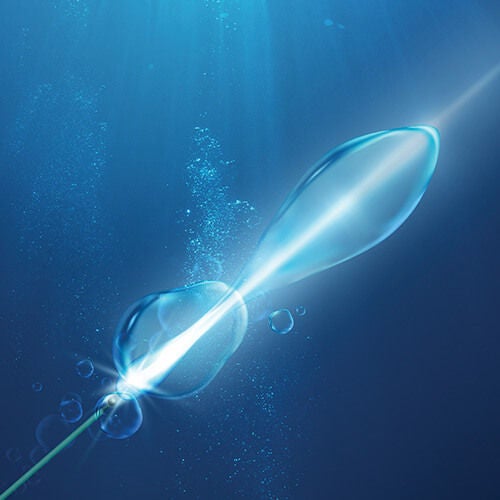 Moses 2.0 example of technology.