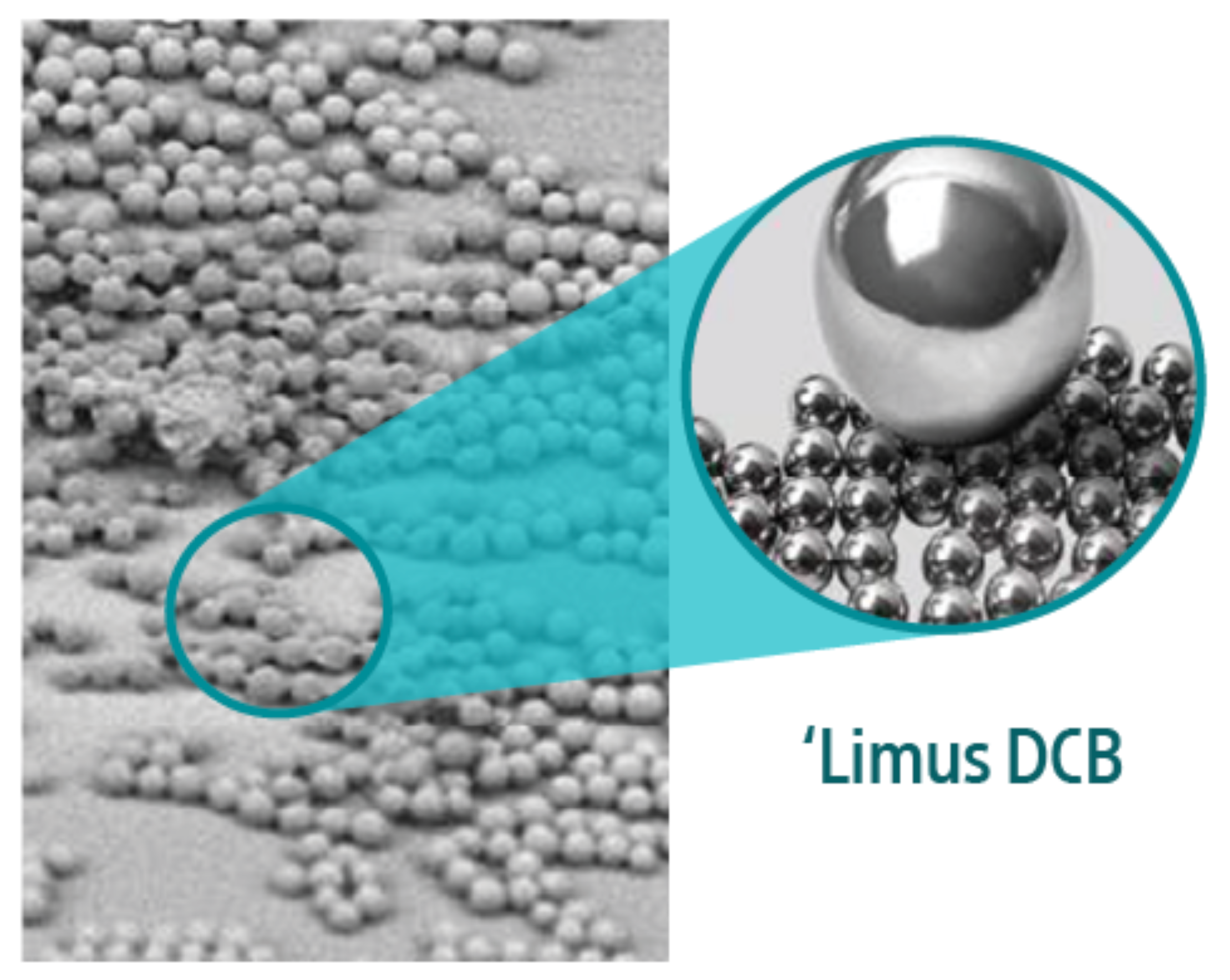 ‘Limus DCB: Spherical structure.