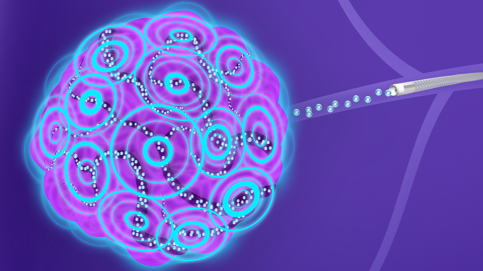TheraSphere™ Y-90 Glass Microspheres - Boston Scientific