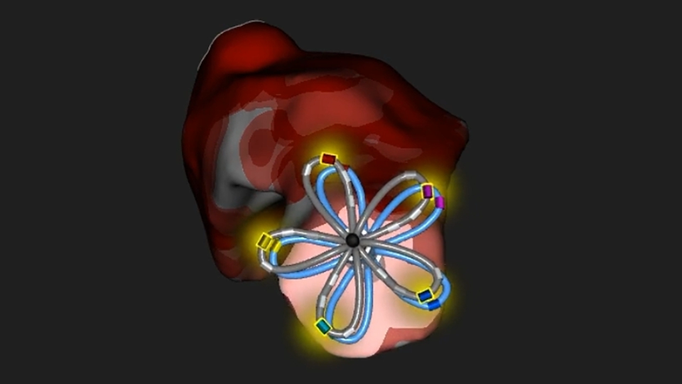 Faraview cardiac map showing PFA catheter in vein