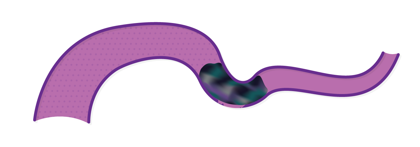 Obsidio conformable slow injection deployment final state.