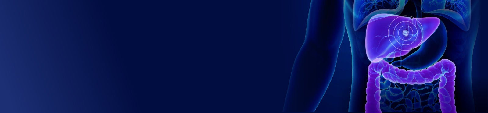 therasphere-clinical-data-hero