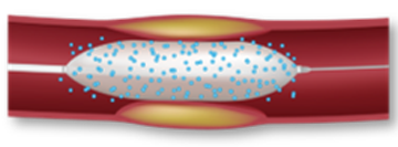 A scientific drawing of AGENT DCB in a vessel illustrating rapid absorption. 