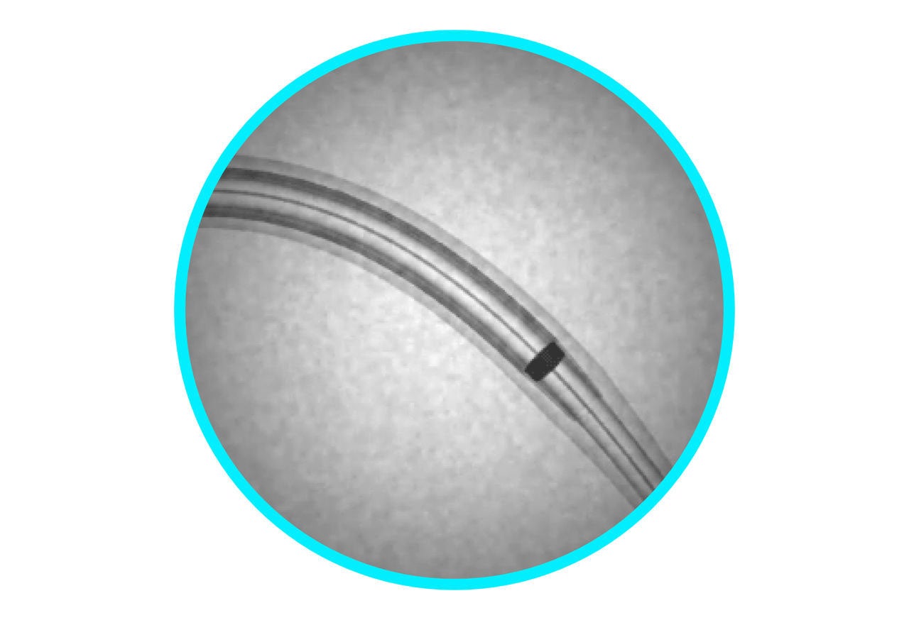 Platinum irridium marker.