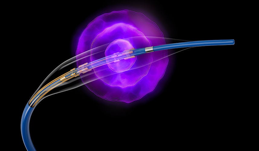 Image of peripheral SEISMIQ Intravascular Lithotripsy Catheter.