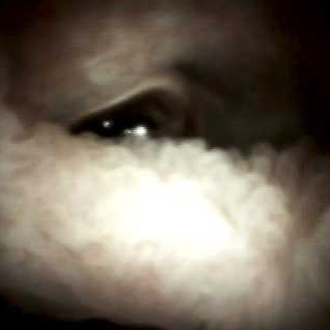 Clinical image of Normal villous pattern (DS I).